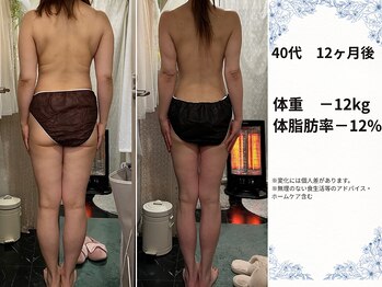 ヨサパーク ブリス(YOSA PARK blis)/40代 12ヶ月
