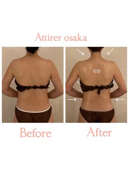 アティレ オオサカ(Attirer Osaka)/ブライダル肩甲骨’天使の羽造り