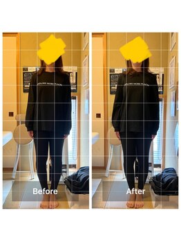 アットユウ(@yu)/フェムケア矯正