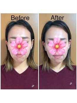 カイロプラクティック ネクサス/顔の歪み撃退☆