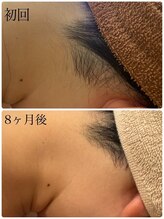 スリーズララ(Cerise LaLa)/