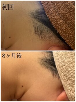 スリーズララ(Cerise LaLa)/