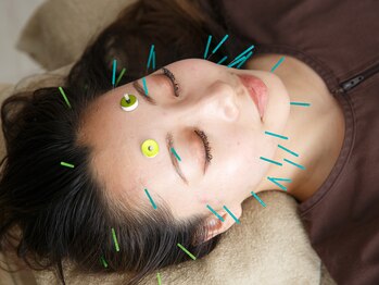 プライムライフ(prime-life)/美容鍼で触れたくなる、ハリ肌へ