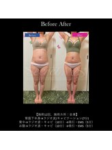 フェレザ 新潟(Felleza)/新潟-痩身エステ-BODYエステ