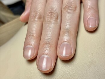 ヨナ バイ ソレカ(YONA bySORECA)の写真/【YONA式・自爪育成ケア】爪が薄い・割れる・折れる・乾燥・形が気になる…そんなお悩みを解決します。