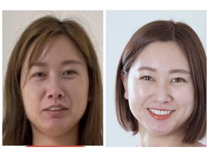 ルアナの写真