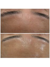 アネラ キキ サロン(anela kiki salon)/シェービングエステ