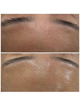 アネラ キキ サロン(anela kiki salon)/シェービングエステ