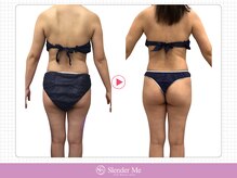 スレンダーミー 甲府本店(Slender Me)/ダイエット実績