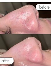 サロン ド カスケード(Salon de Cascade)/20代女性