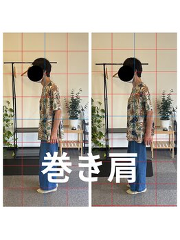 熊本カワル整体 JR上熊本駅院/巻き肩