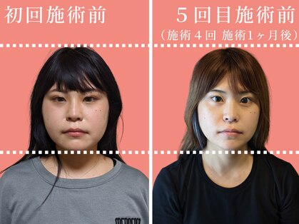 鍼屋フミ(鍼屋FUMI)の写真