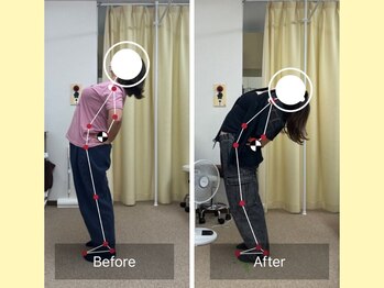 ナオル整体 大宮院(NAORU整体)/腰痛改善！[整体・骨盤矯正]