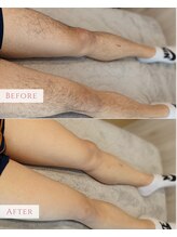 マシェリ(MA CHERIE)/足WAX&光