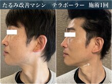 アリイ(Alii)の雰囲気（【たるみケア】エイジングのお悩みはテラボーラーにお任せ♪）
