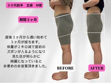 ビジリンヌ/ビフォーアフター３ヶ月