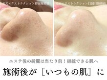 フラコン(flacon.)