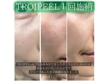 カルナ(CARNA)の雰囲気（根本肌改善。TROIPEEL◎最短で肌改善したい方、全ての肌質に◎）