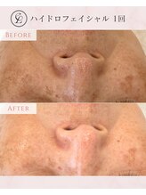 エンルーチェ(en;Luce)/ハイドロ＋エレポレで潤い肌へ