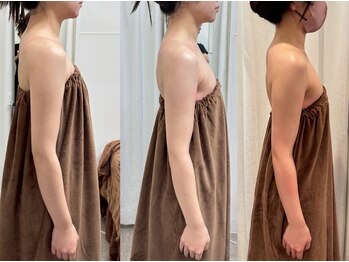 ロココ 豊田店(Rococo)/ビフォーアフター