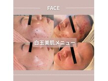 フェミプレイス(Femi Place)の雰囲気(ニキビ/シミ/美白など様々なお悩みを解決する白玉美肌メニュー)