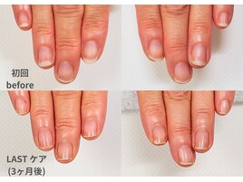 【地爪育成 症例１】