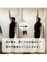 なぎのき鍼灸治療院/首の疲れ・肩こりのお悩みケア！