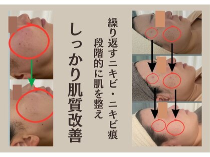 アンドスロウ(&slow)の写真