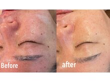 メナードフェイシャルサロン 中萩/