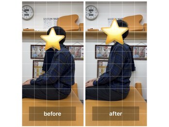 ナオル整体 飯田橋院(NAORU整体)/Before After/飯田橋/整体・矯正