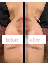 チェリーブロッサム 上福岡店(CHERRY BLOSSOM)/