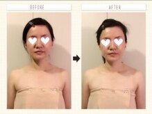 ハピア(HappiA)/リフトアップ顔筋コルギ