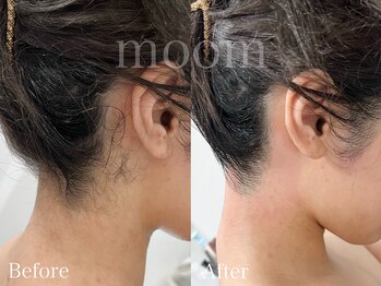 ムーム なんば店(moom)/うなじワックスで垢抜ける