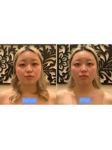 アジール 長岡リバーサイド千秋店(agir)/Before/After画像