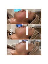 サンジュウロクドゴブ(36.5℃)/マシン × レストセル