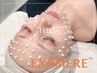 体験【最新！韓国で話題】72時間で肌質改善★微細針350万ショット『EXOMERE』