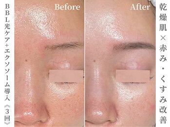 ゼアー(THERE FY.)/