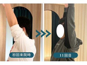 リリーフポート 大手町店/施術での結果