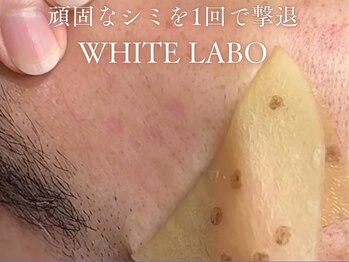 アリウム(ALLIUM)/ホワイトラボ