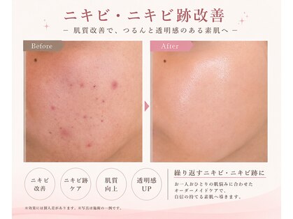 アイリス(AiRiS)の写真