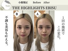 ザ ハイライト 恵比寿の雰囲気（顔のむくみ、歪み、左右差、リフトアップもお任せください☆）