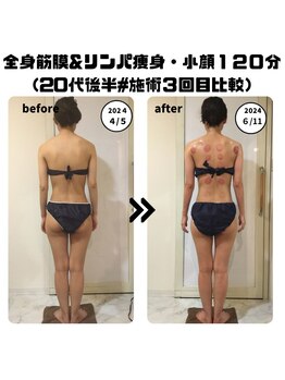 シェルシア(Cielcia)/ブライダルプラン3回目