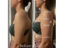 ビウラ(BIURA)/【20代】姿勢改善