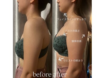 ビウラ(BIURA)/【20代】姿勢改善