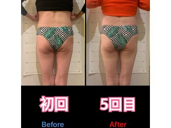 美尻研究所 福岡大名店/