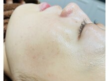 ヨシザワ インク 横浜みなとみらい桜木町店(YOSHIZAWA Inc.)/フェイスシェービング