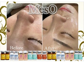 サロンフィーユ(Fille)/「肌の”内側”で決まる」