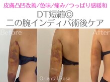 オリエンタルローザ 表参道(Oriental Rosa)/二の腕インディバ術後ケア