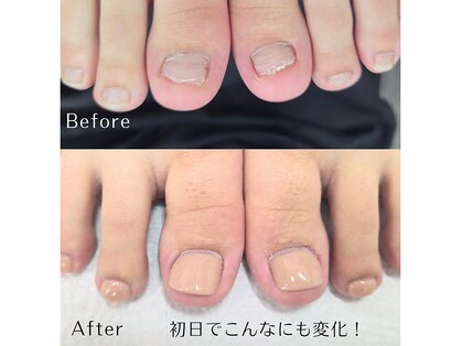 キュアネイル(Qa Nail)の写真