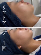 ザ ピーチ(THE PEACH)/大人気オンダリフト ♪